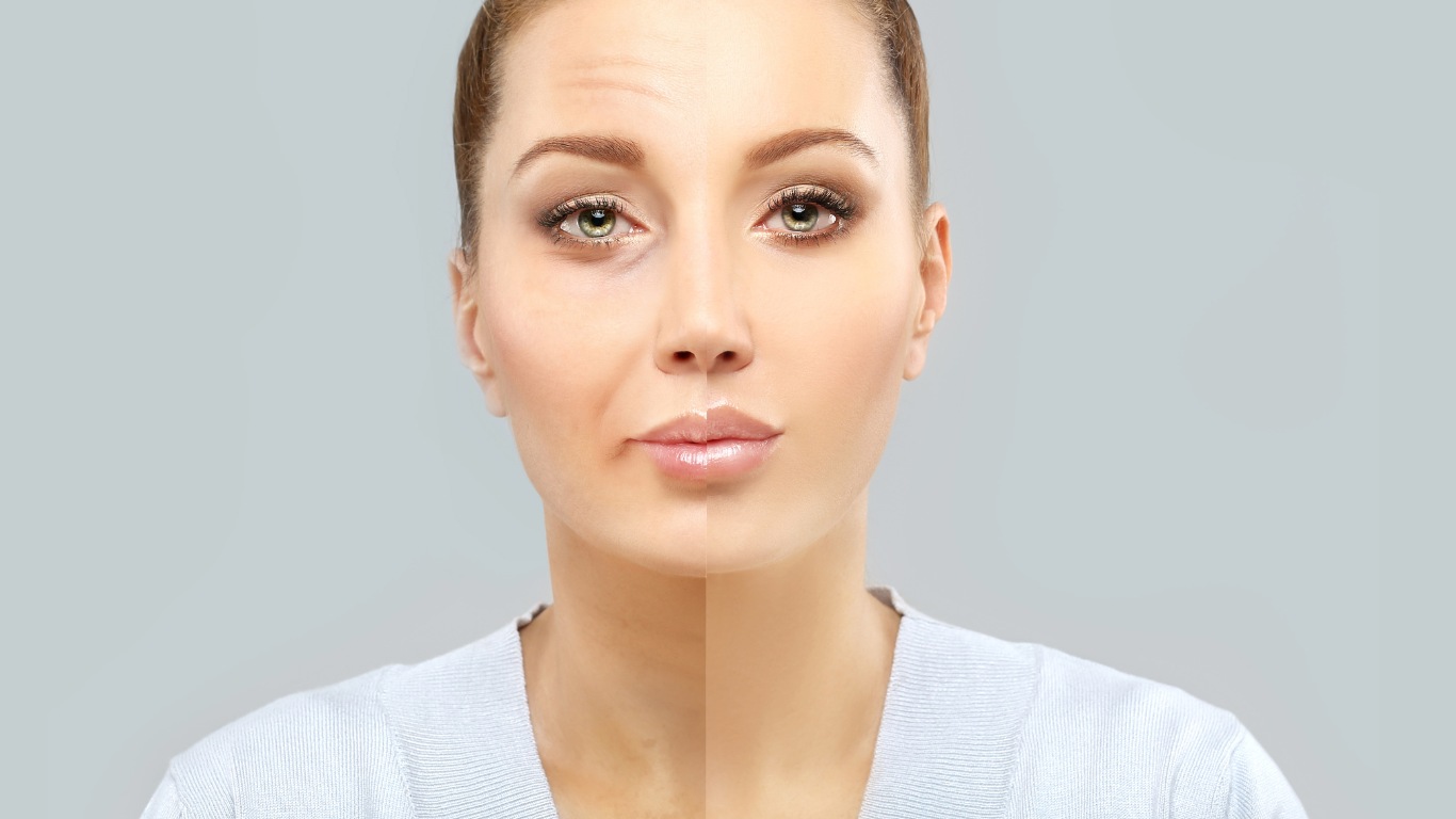 Before and After Skin Transformation Side-by-side comparison showing noticeable skin improvement before and after following gut health and skincare tips, emphasizing clearer and more radiant skin.